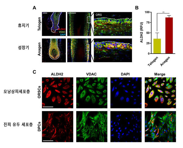 ALDH2 발현 수준의 변화를 평가하기 위해 모낭의 면역염색을 수행할 결과 성장기에 주로 모낭의 가장 바깥쪽 층(모낭상피세포층)에서 ALDH2가 뚜렷한 강도로 발현됐다.(A) 상대적인 ALDH2 수준은 진피 유두 세포층 보다 모낭상피세포층에서 훨씬 더 높았다.(C) 자료=Journal of Advanced Research